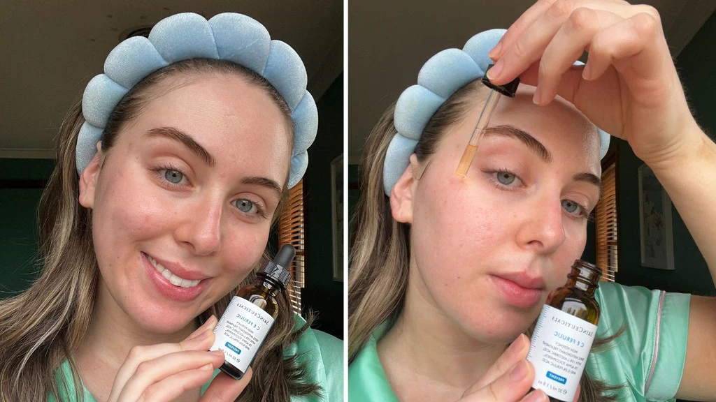 skinceuticals triple lipid restore before and after